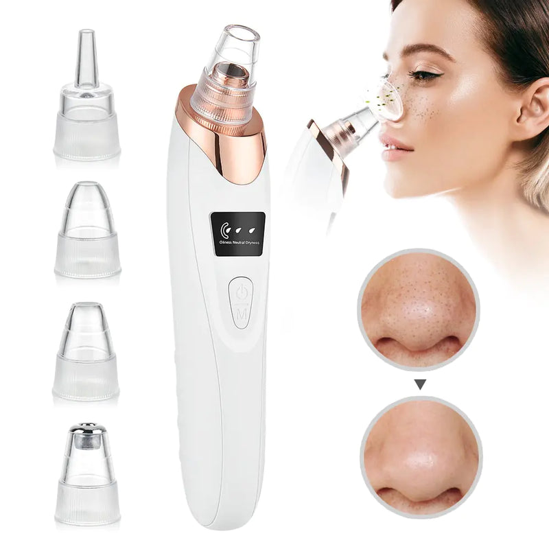 Load image into Gallery viewer, Beauty Electric Blackhead Remover
